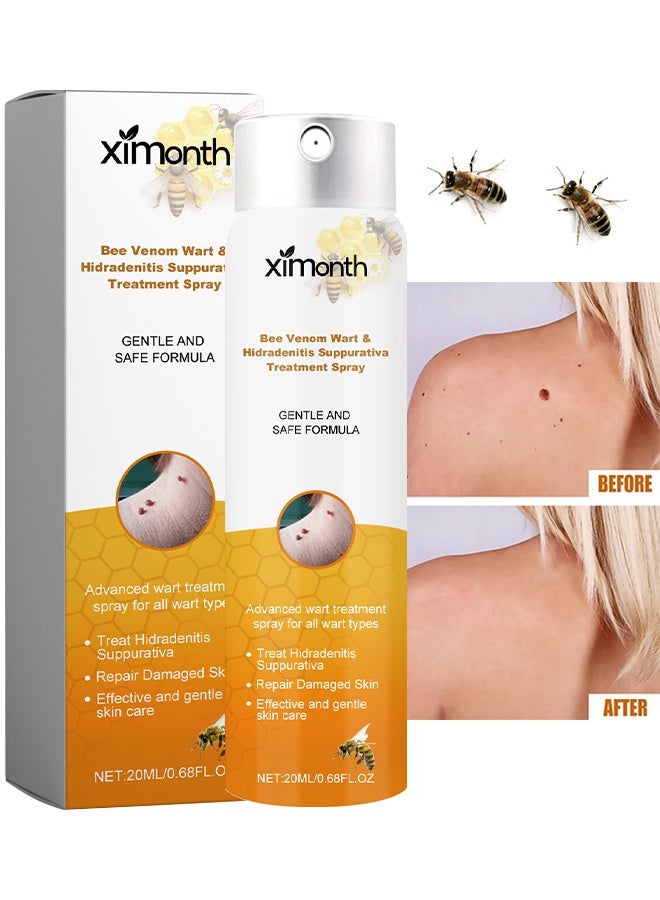 ximonth Bee Venom Wart Removal Spray, Bee Venom Wart Removal Solution, Wart Removal Freezer, Wart Removal Spray, Skin Tag Removal, Painless Removal Of Skin Tags And Moles 20ml - Image 1